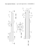 SYSTEMS AND METHODS FOR TREATING SEPTAL DEFECTS diagram and image