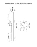 SYSTEMS AND METHODS FOR TREATING SEPTAL DEFECTS diagram and image