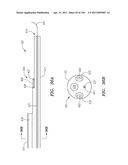 SYSTEMS AND METHODS FOR TREATING SEPTAL DEFECTS diagram and image