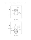 SYSTEMS AND METHODS FOR TREATING SEPTAL DEFECTS diagram and image