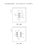 SYSTEMS AND METHODS FOR TREATING SEPTAL DEFECTS diagram and image