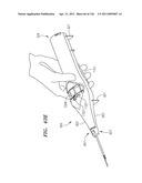 SYSTEMS AND METHODS FOR TREATING SEPTAL DEFECTS diagram and image