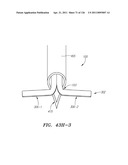 SYSTEMS AND METHODS FOR TREATING SEPTAL DEFECTS diagram and image