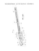 SYSTEMS AND METHODS FOR TREATING SEPTAL DEFECTS diagram and image