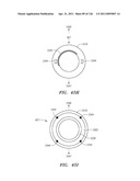 SYSTEMS AND METHODS FOR TREATING SEPTAL DEFECTS diagram and image