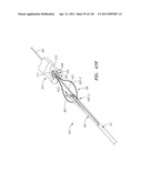 SYSTEMS AND METHODS FOR TREATING SEPTAL DEFECTS diagram and image