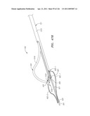 SYSTEMS AND METHODS FOR TREATING SEPTAL DEFECTS diagram and image