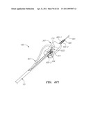 SYSTEMS AND METHODS FOR TREATING SEPTAL DEFECTS diagram and image