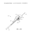 SYSTEMS AND METHODS FOR TREATING SEPTAL DEFECTS diagram and image