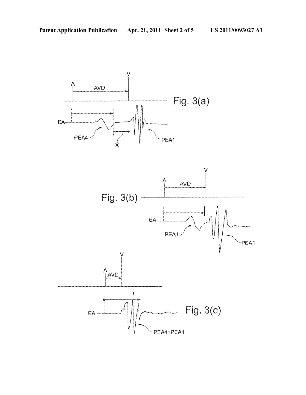 Active Implantable Medical Device For Cardiac Resynchronization With Automatic Optimization Of Atrioventricular And Interventricular Delays - diagram, schematic, and image 03