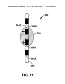 PROGRAMMING TECHNIQUES FOR STIMULATION WITH UTILIZATION OF CASE ELECTRODE diagram and image