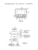 SYSTEM AND METHOD FOR ESTIMATING VOLUME OF ACTIVATION IN TISSUE diagram and image