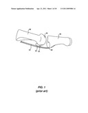 ARTIFICIAL JOINT PRESERVING TENDON AND/OR SESAMOID BONE STRUCTURE diagram and image