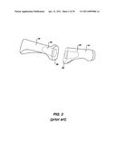 ARTIFICIAL JOINT PRESERVING TENDON AND/OR SESAMOID BONE STRUCTURE diagram and image