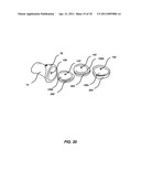 ARTIFICIAL JOINT PRESERVING TENDON AND/OR SESAMOID BONE STRUCTURE diagram and image