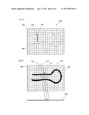 CUSTOMISED SURGICAL APPARATUS diagram and image