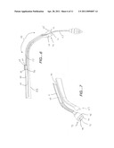 RETRACTABLE EARPLUG APPARATUS FOR AN EYEWEAR ASSEMBLY AND A VEST ASSEMBLY diagram and image