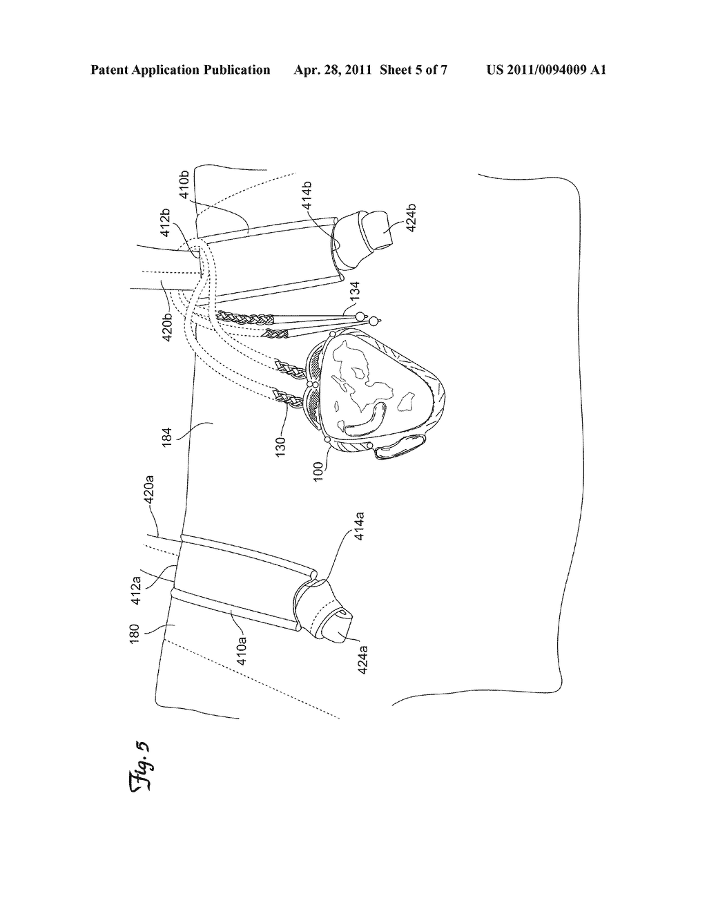 Application of Bolo Ties to Personal and Decorative Articles - diagram, schematic, and image 06