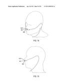 METHODS, SYSTEMS AND DEVICES FOR NON-INVASIVE VENTILATION INCLUDING A NON-SEALING VENTILATION INTERFACE WITH A FREE SPACE NOZZLE FEATURE diagram and image