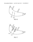 METHODS, SYSTEMS AND DEVICES FOR NON-INVASIVE VENTILATION INCLUDING A NON-SEALING VENTILATION INTERFACE WITH A FREE SPACE NOZZLE FEATURE diagram and image