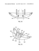 METHODS, SYSTEMS AND DEVICES FOR NON-INVASIVE VENTILATION INCLUDING A NON-SEALING VENTILATION INTERFACE WITH A FREE SPACE NOZZLE FEATURE diagram and image