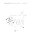 DENTAL APPLIANCE AND METHODS OF USING THE SAME diagram and image