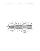 Method For Manufacturing A Balloon Encapsulated Catheter Tip diagram and image