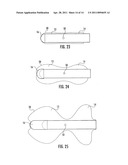 Method For Manufacturing A Balloon Encapsulated Catheter Tip diagram and image