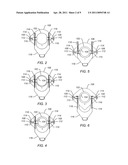 PULL-HEAD RELEASE MECHANISM FOR BEND STIFFENER CONNECTOR diagram and image