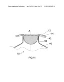 Sealing Lid diagram and image