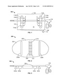 SECUREMENT OF LAPAROSCOPIC INSTRUMENTS ON THE STERILE SURGICAL FIELD diagram and image