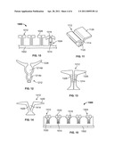 SECUREMENT OF LAPAROSCOPIC INSTRUMENTS ON THE STERILE SURGICAL FIELD diagram and image