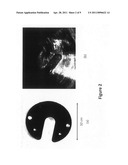 Acoustic imaging of objects in optically opaque fluids diagram and image