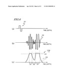 ULTRASOUND DIAGNOSTIC APPARATUS diagram and image