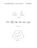 ULTRASOUND IMAGE ENHANCEMENT AND SPECKLE MITIGATION METHOD diagram and image