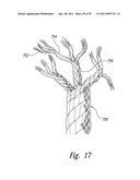 APPARATUSES, SYSTEMS AND METHODS FOR SELECTIVELY AFFECTING MOVEMENT OF A MOTOR VEHICLE diagram and image