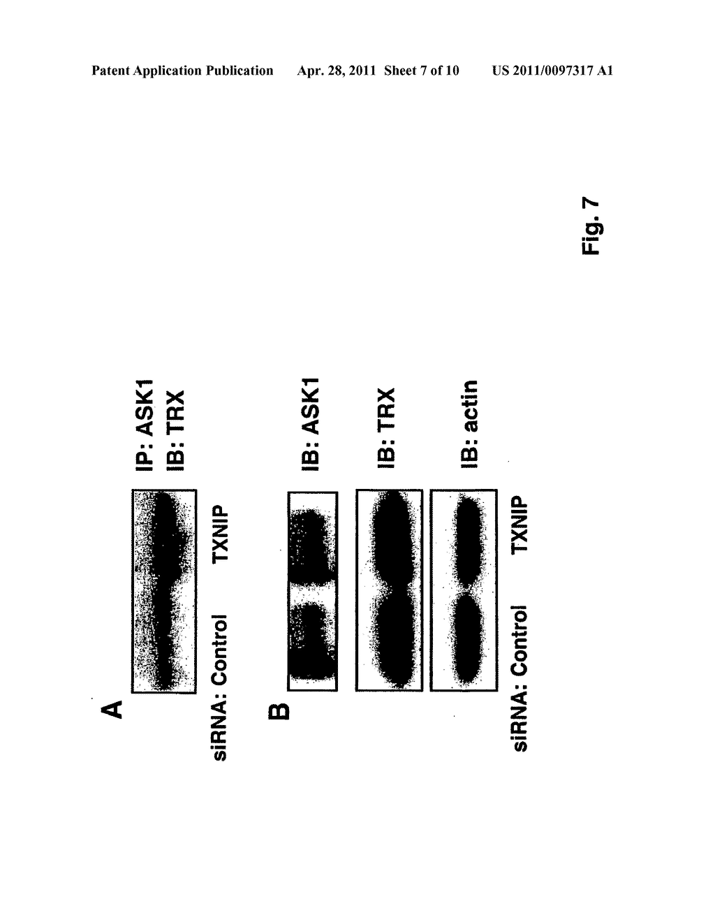 Thioredoxin Interacting Protein (TXNIP) As Regulator Of Vascular Function - diagram, schematic, and image 08