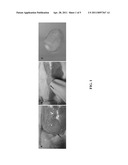 MONOLITHIC IN-SITU CROSS-LINKED ALGINATE IMPLANTS diagram and image