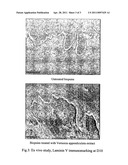 Use of vernonia extract diagram and image