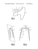 METHOD FOR PRODUCING A CUSTOMISED ORTHODONTIC DEVICE, AND DEVICE PRODUCED IN THIS MANNER diagram and image