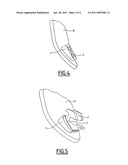 METHOD FOR PRODUCING A CUSTOMISED ORTHODONTIC DEVICE, AND DEVICE PRODUCED IN THIS MANNER diagram and image