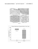 Methods and Compositions for Diagnosing and Treating Cervical Intraepithelial Neoplasia and Cervical Cancer diagram and image