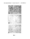 CATHECHINS FOR THE TREATMENT OF SYSTEMIC AA AMYLOIDOSIS diagram and image