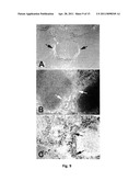 CATHECHINS FOR THE TREATMENT OF SYSTEMIC AA AMYLOIDOSIS diagram and image