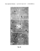 CATHECHINS FOR THE TREATMENT OF SYSTEMIC AA AMYLOIDOSIS diagram and image