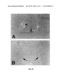 CATHECHINS FOR THE TREATMENT OF SYSTEMIC AA AMYLOIDOSIS diagram and image