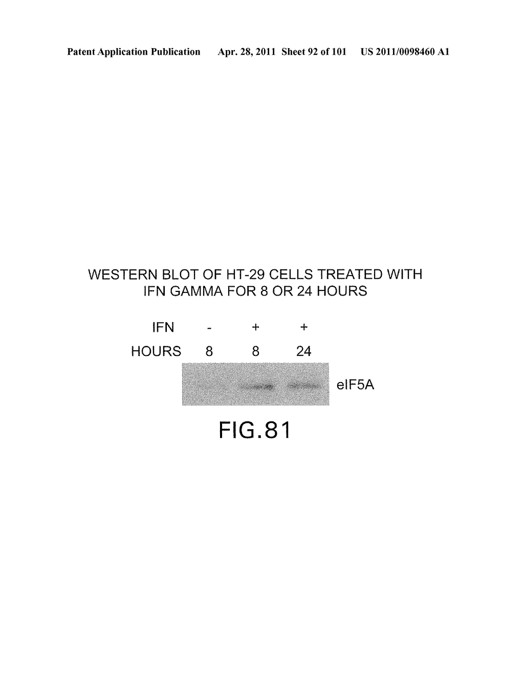 SiRNA Useful to Suppress expression of eIF-5A1 - diagram, schematic, and image 93