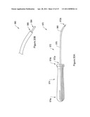 PELVIC FLOOR REPAIR SYSTEM diagram and image