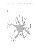 PELVIC FLOOR REPAIR SYSTEM diagram and image