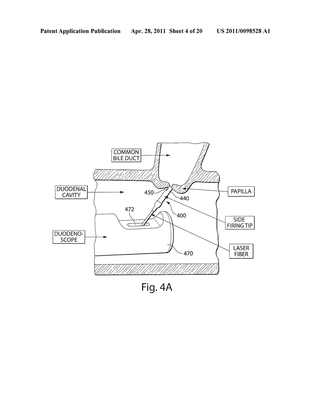 FIBERS AND TIPS THEREOF USED WITH DEVICES - diagram, schematic, and image 05